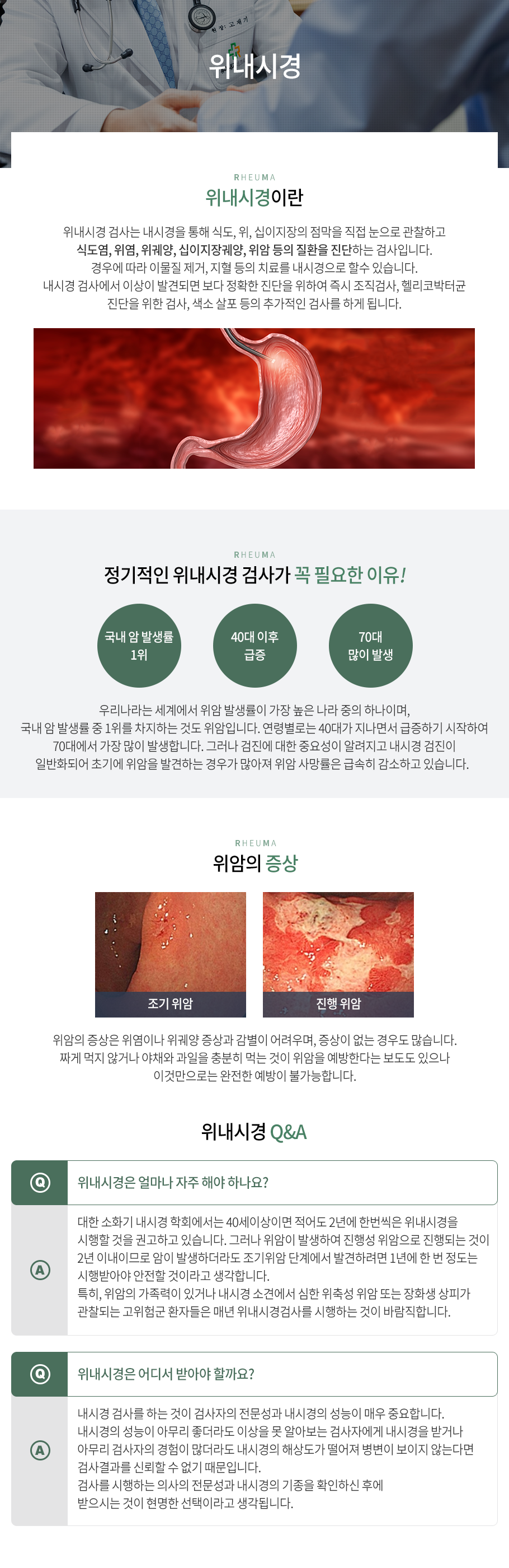 위내시경