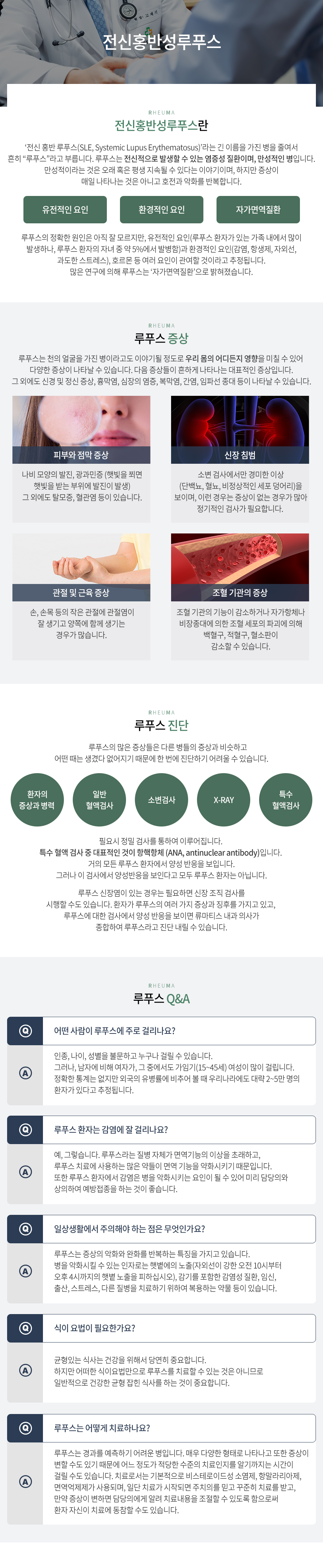 전신홍반성루푸스